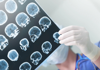 Medical Imaging and Radiology